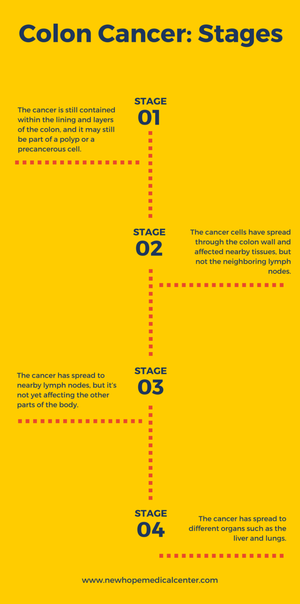 Colon Cancer Stages Types Of Colon Cancer: Specialist Guide To Stage