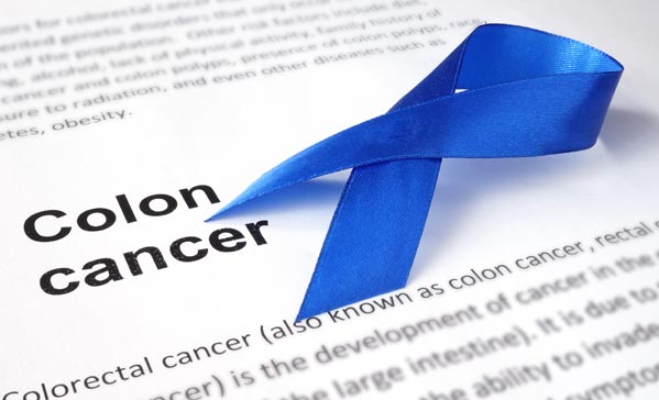 Colon Cancer