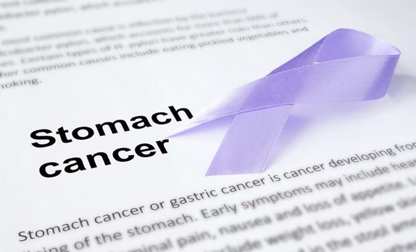 Stomach Cancer