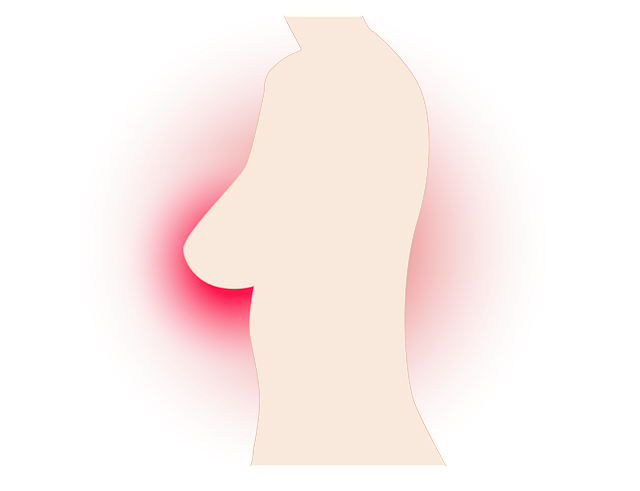 breast cancer recurrence